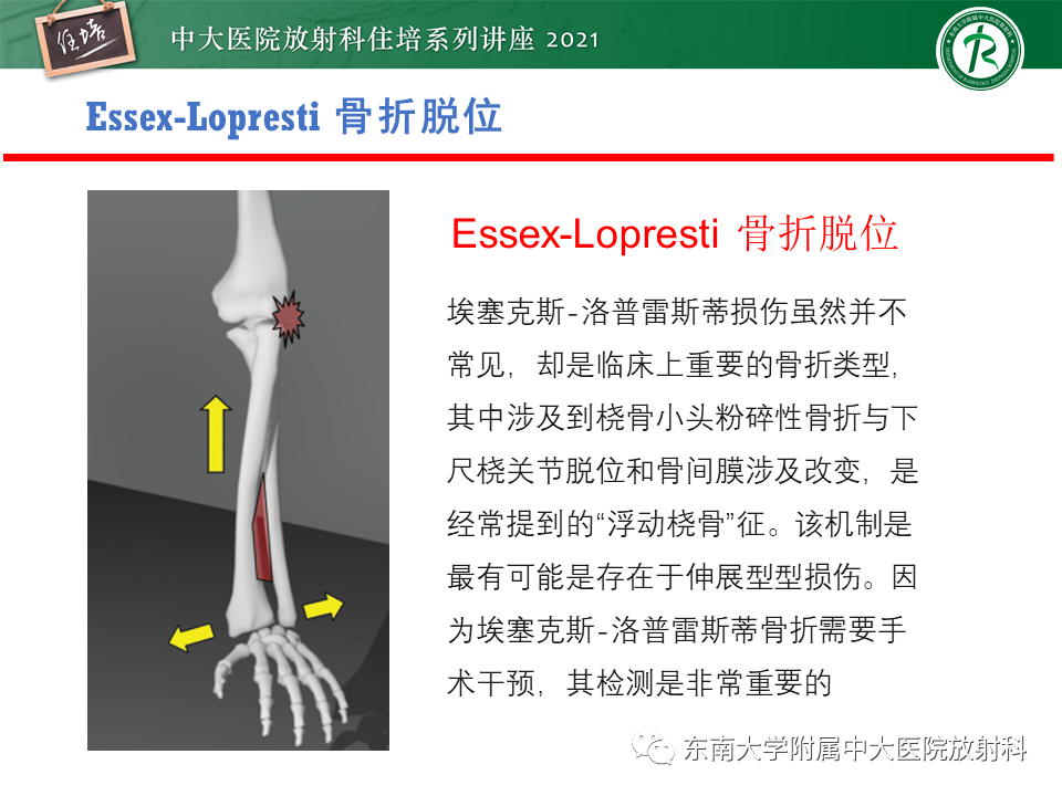 影像PPT - 【PPT】肘关节损伤-6
