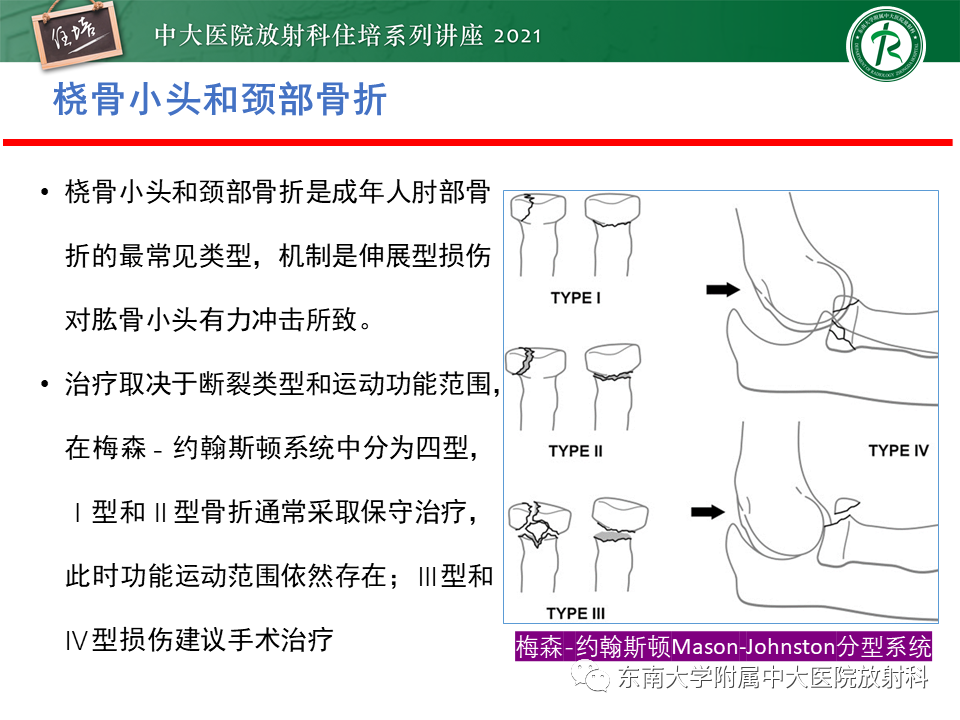影像PPT - 【PPT】肘关节损伤-3