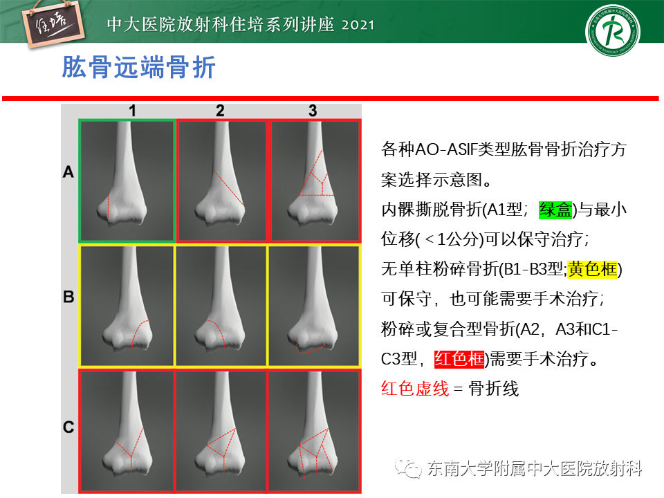 影像PPT - 【PPT】肘关节损伤-7