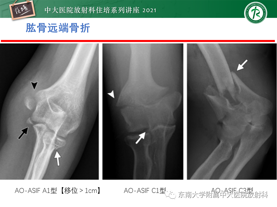 影像PPT - 【PPT】肘关节损伤-8