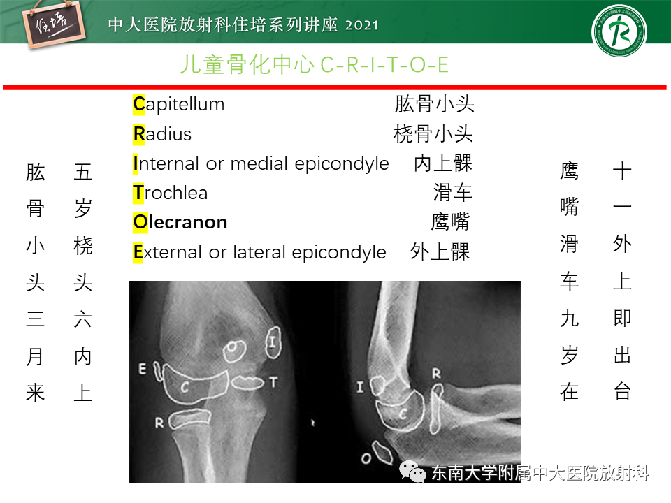 影像PPT - 【PPT】肘关节损伤-18