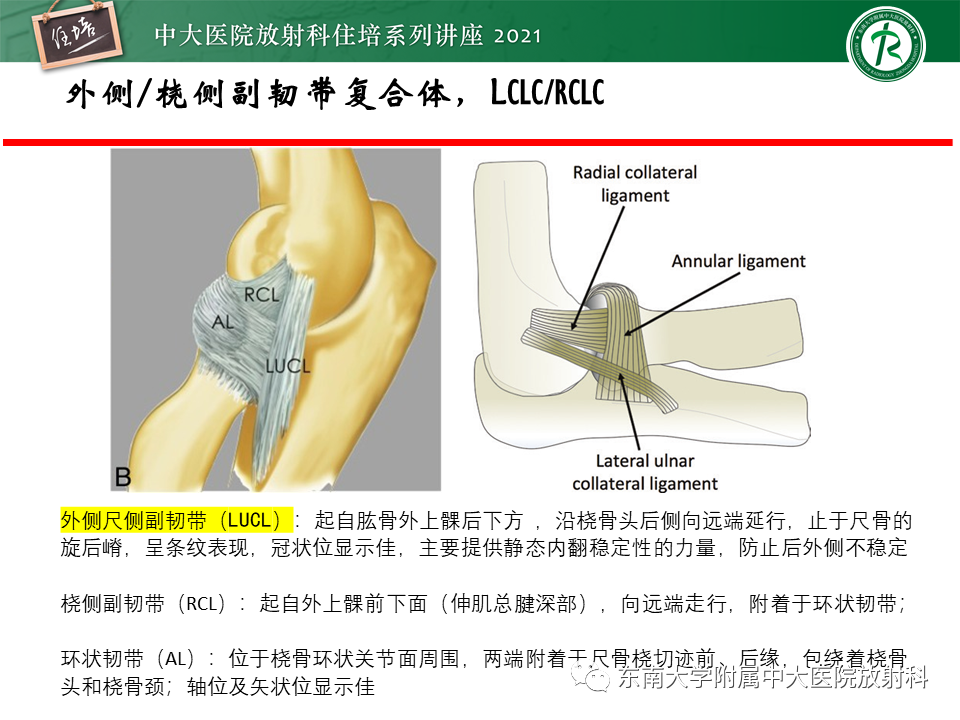 影像PPT - 【PPT】肘关节损伤-36
