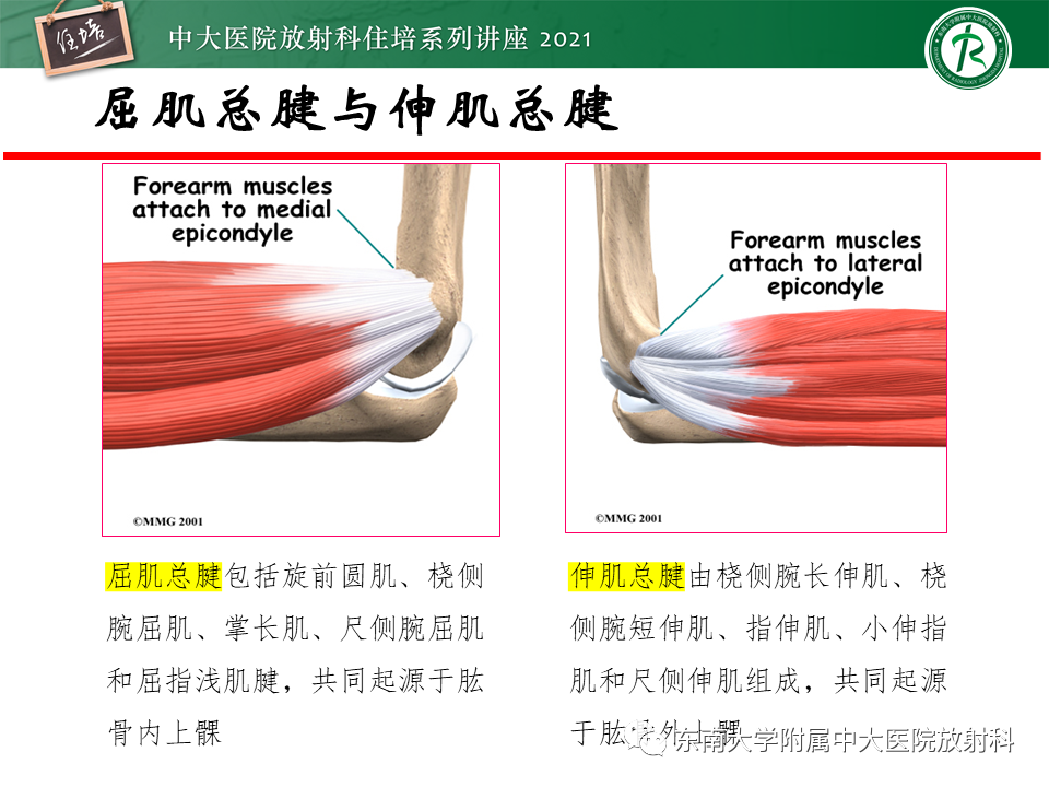 影像PPT - 【PPT】肘关节损伤-46