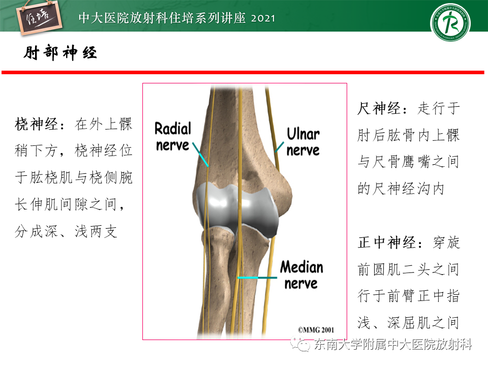 影像PPT - 【PPT】肘关节损伤-56
