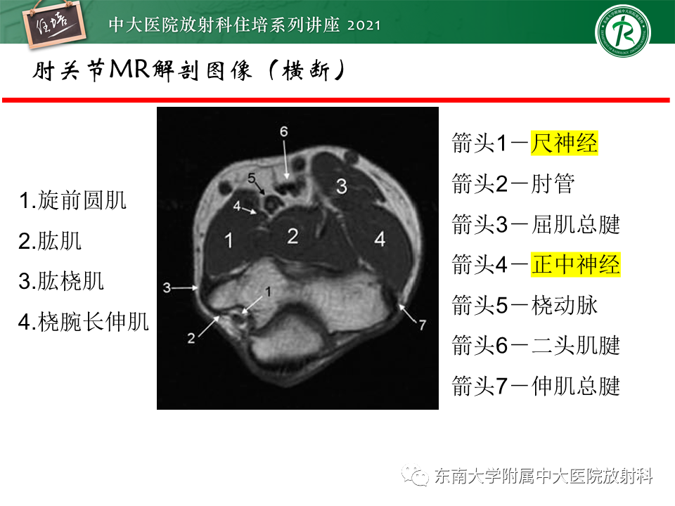 影像PPT - 【PPT】肘关节损伤-57