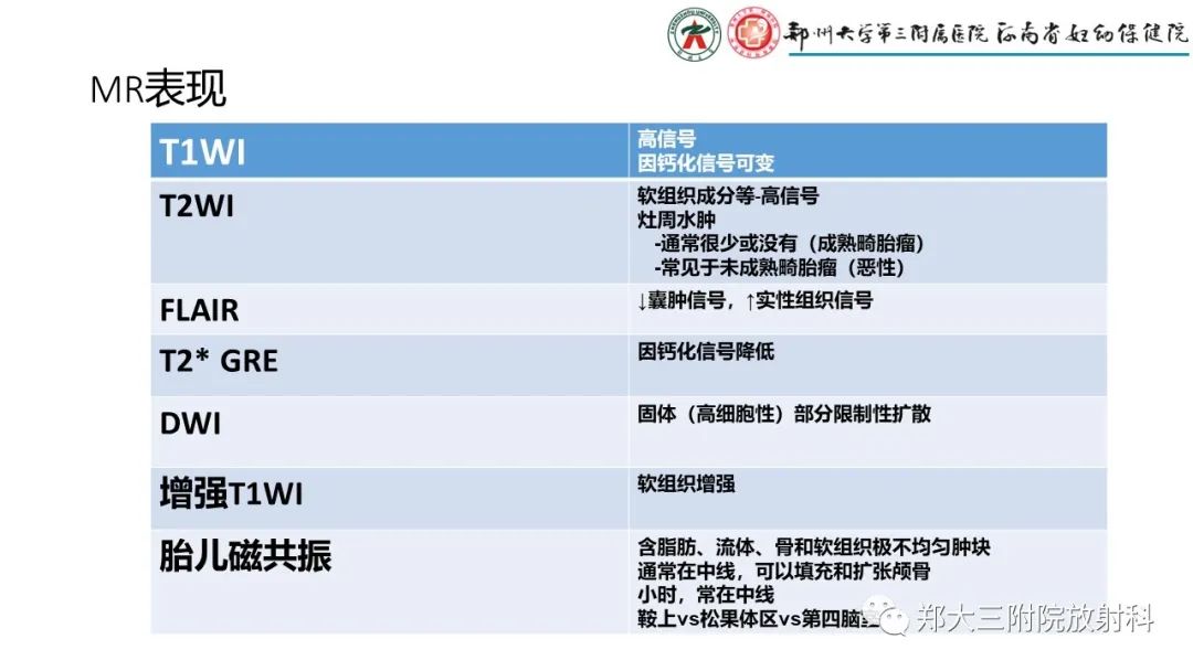 影像PPT - 【PPT】松果体区病变及影像表现-30