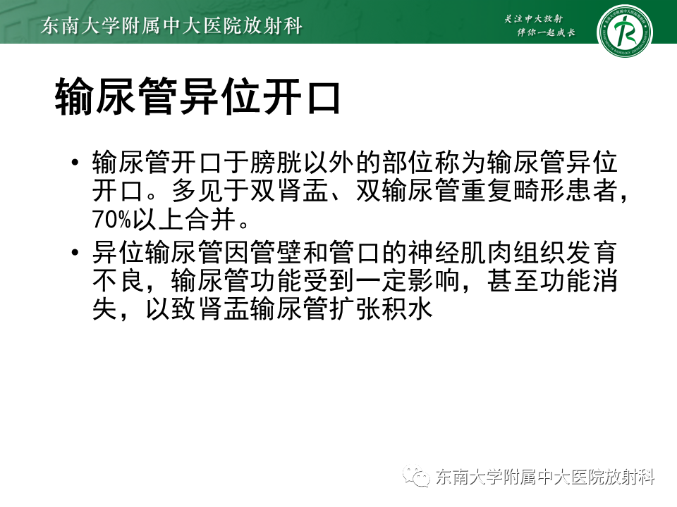 影像PPT - 【PPT】下腔静脉后输尿管及输尿管先天变异-16