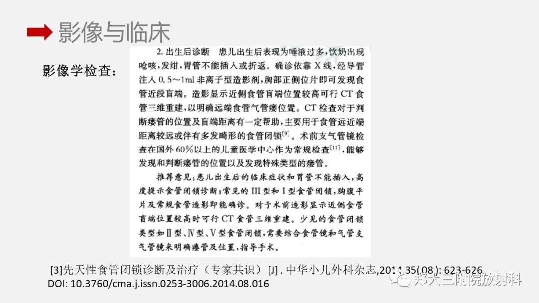 影像PPT - 【PPT】先天性食管闭锁-11