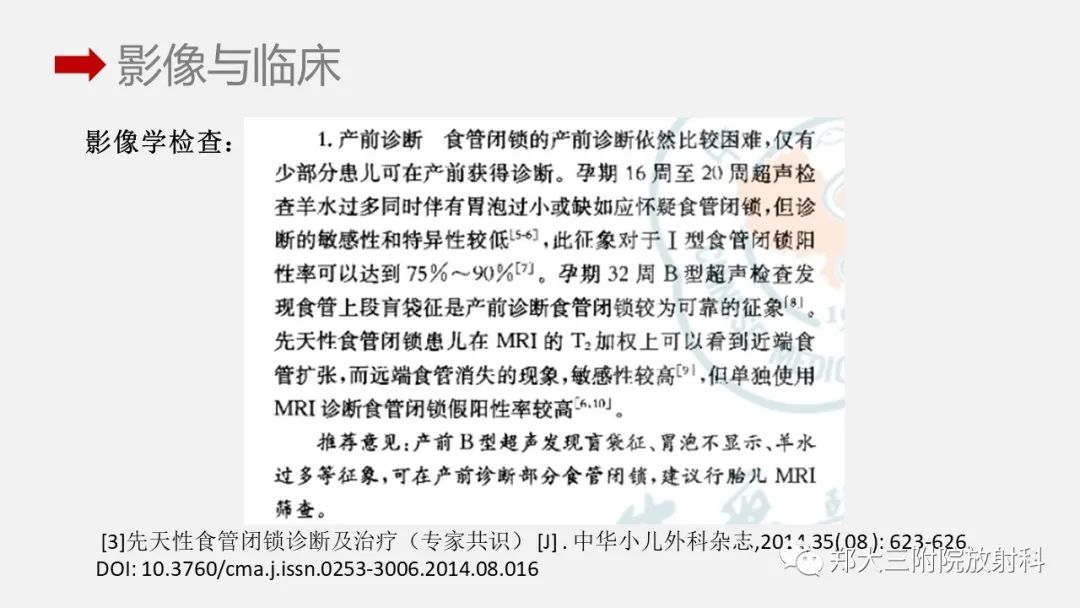 影像PPT - 【PPT】先天性食管闭锁-10