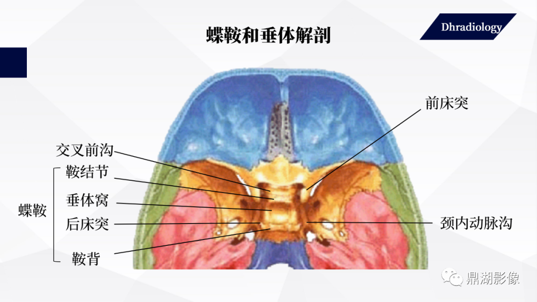 影像PPT - 【PPT】垂体瘤影像诊断-3