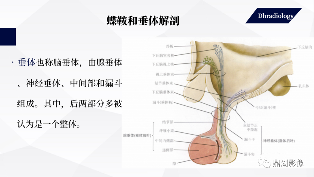影像PPT - 【PPT】垂体瘤影像诊断-5