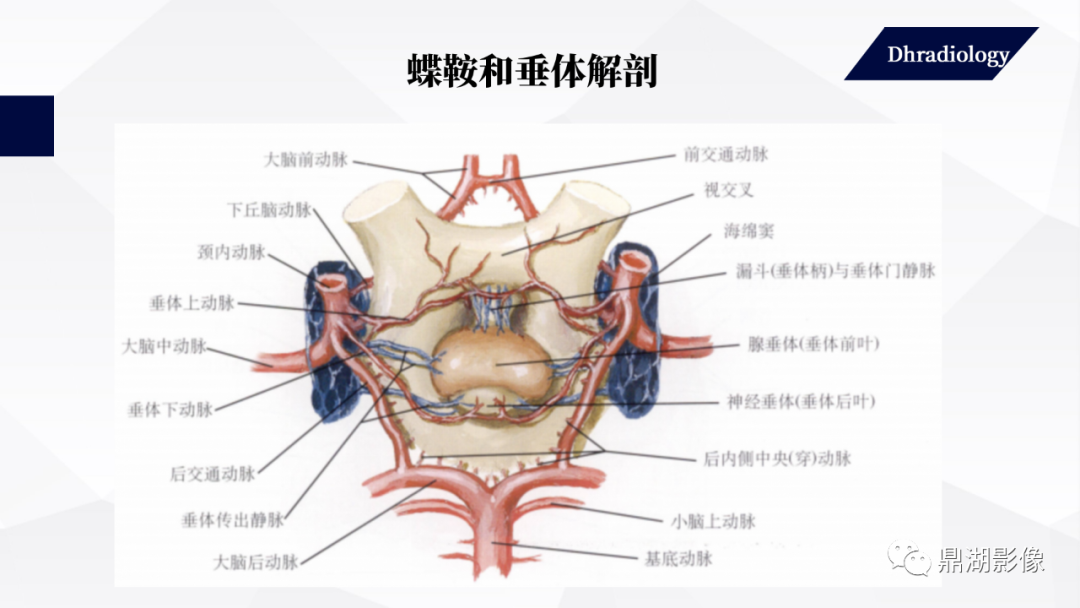 影像PPT - 【PPT】垂体瘤影像诊断-9
