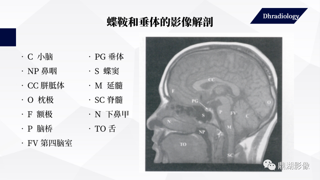 影像PPT - 【PPT】垂体瘤影像诊断-10
