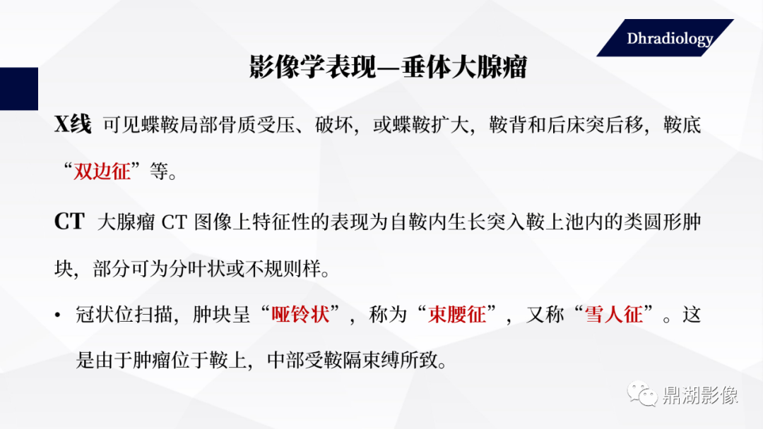 影像PPT - 【PPT】垂体瘤影像诊断-33
