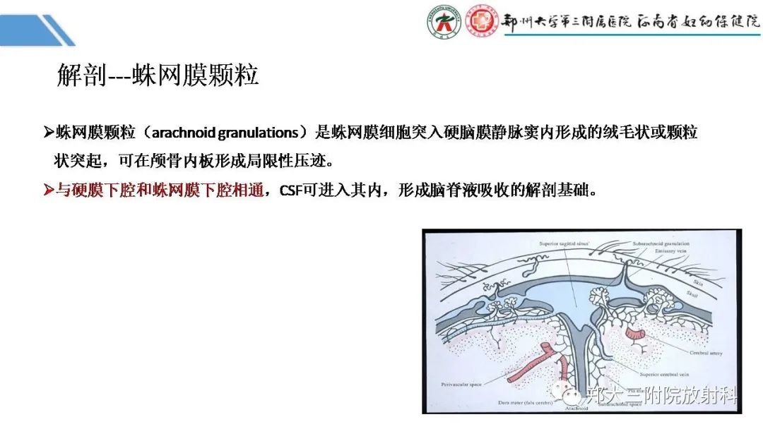 影像PPT - 【PPT】蛛网膜颗粒的影像学表现-3