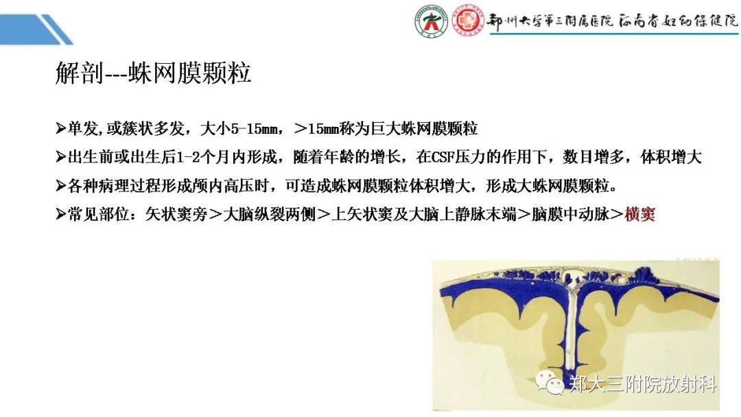 影像PPT - 【PPT】蛛网膜颗粒的影像学表现-4