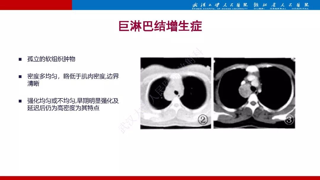 影像PPT - 【PPT】异位甲状旁腺腺瘤的影像诊断-20