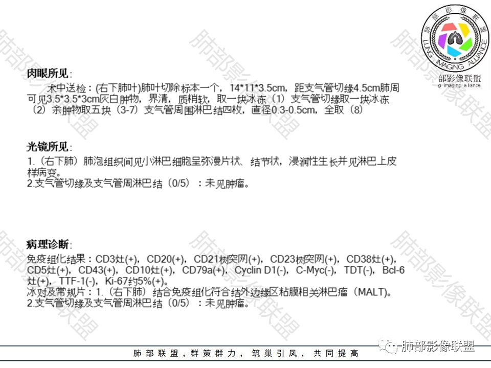 影像PPT - 【病例】不那么陌生的MALT-38 影像PPT - 【病例】不那么陌生的MALT-38