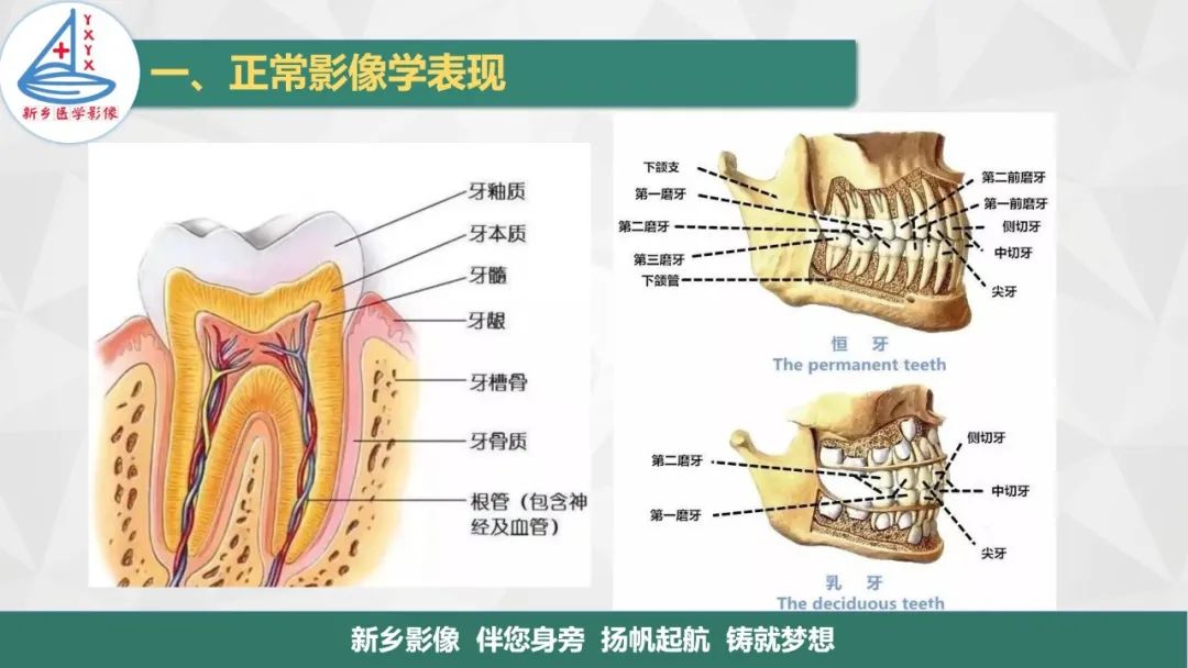 影像PPT - 【PPT】医学影像诊断学教材解读—口腔颌面部疾病-4