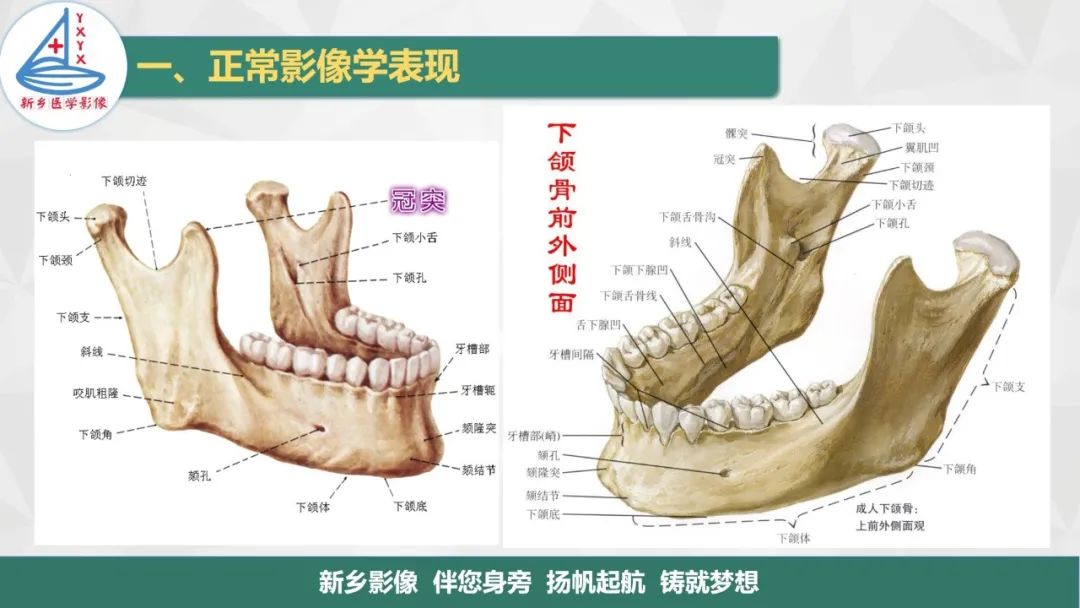 影像PPT - 【PPT】医学影像诊断学教材解读—口腔颌面部疾病-3