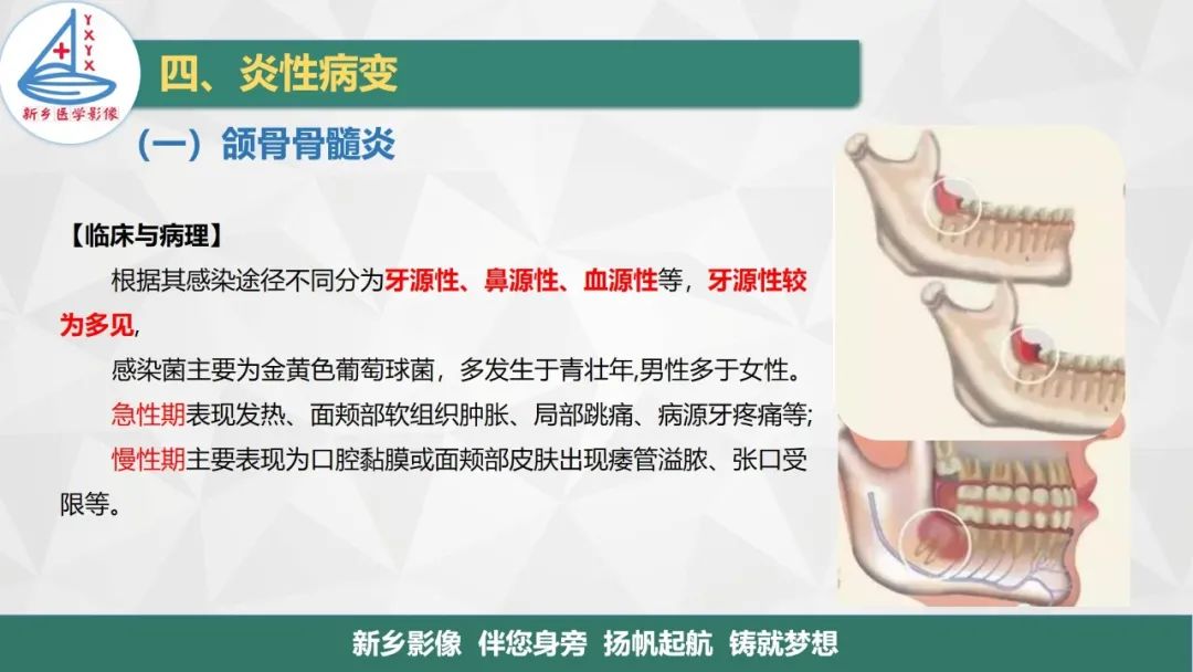 影像PPT - 【PPT】医学影像诊断学教材解读—口腔颌面部疾病-10