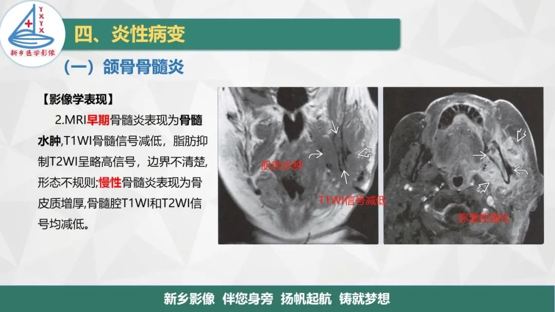 影像PPT - 【PPT】医学影像诊断学教材解读—口腔颌面部疾病-12