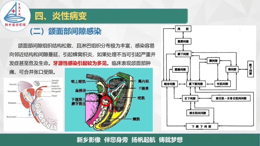 影像PPT - 【PPT】医学影像诊断学教材解读—口腔颌面部疾病-13