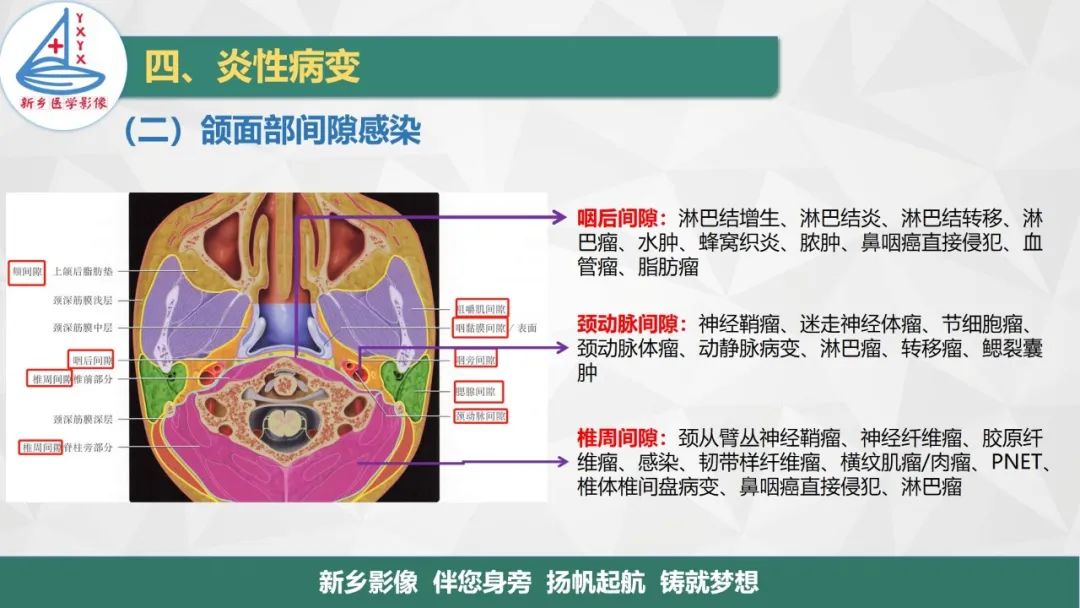 影像PPT - 【PPT】医学影像诊断学教材解读—口腔颌面部疾病-18