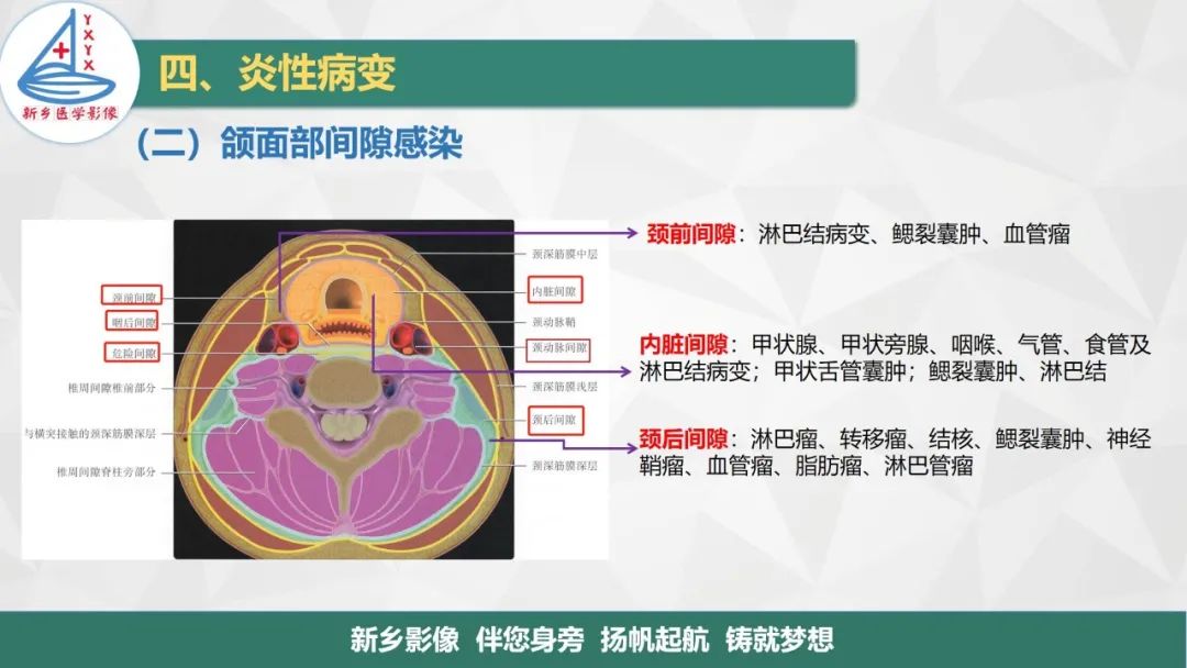 影像PPT - 【PPT】医学影像诊断学教材解读—口腔颌面部疾病-19