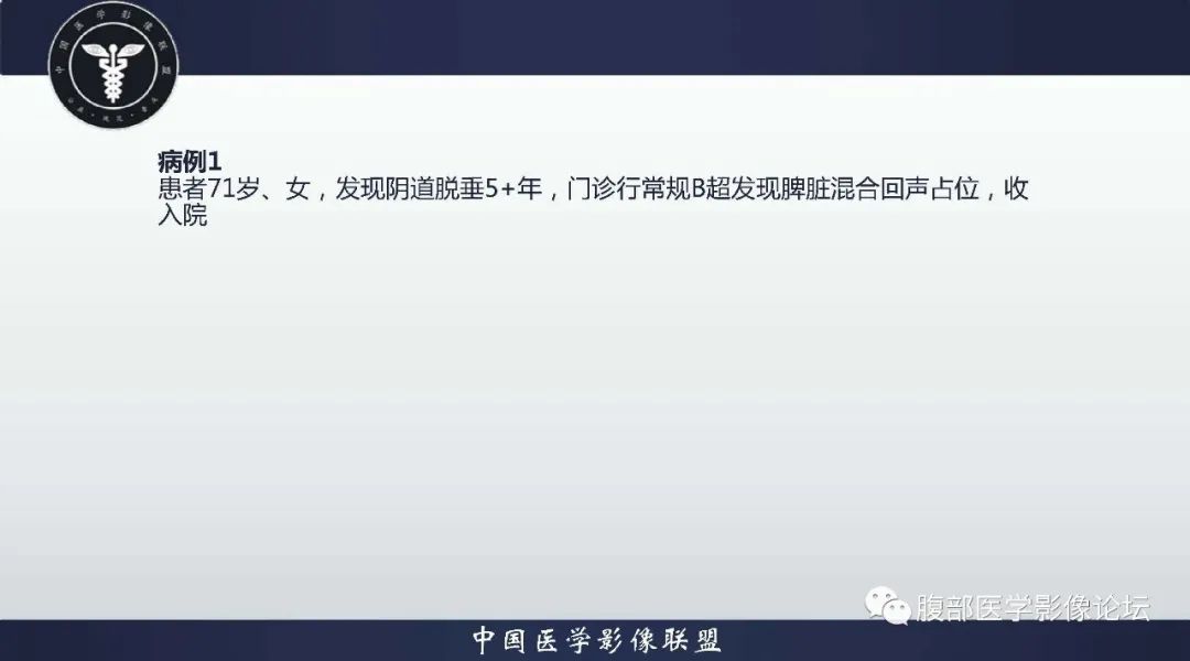 影像PPT - 【病例】脾脏窦岸细胞血管瘤1例CT影像-2 影像PPT - 【病例】脾脏窦岸细胞血管瘤1例CT影像-2