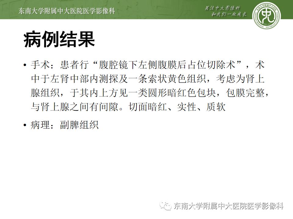 影像PPT - 【PPT】脾脏先天性异常-5