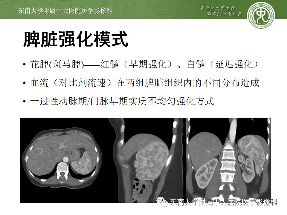 影像PPT - 【PPT】脾脏先天性异常-8