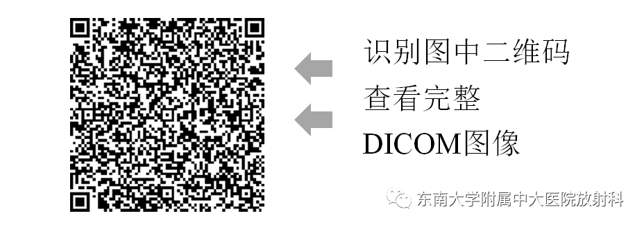 影像PPT - 【PPT】颌下间隙病变影像诊断-3 影像PPT - 【PPT】颌下间隙病变影像诊断-3