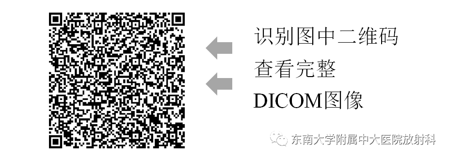 影像PPT - 【PPT】颌下间隙病变影像诊断-9 影像PPT - 【PPT】颌下间隙病变影像诊断-9