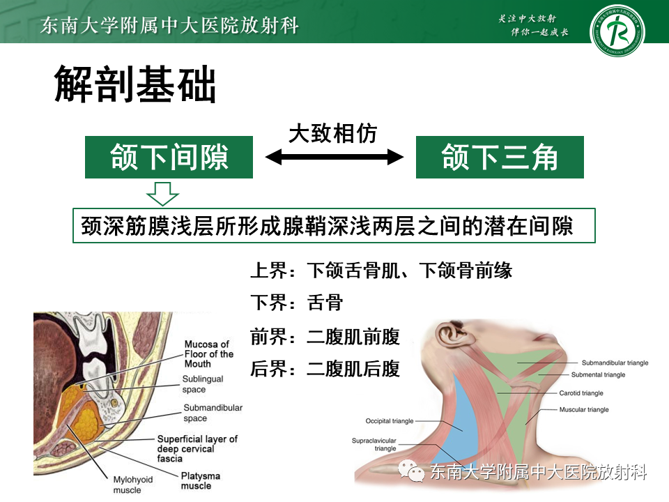 影像PPT - 【PPT】颌下间隙病变影像诊断-25 影像PPT - 【PPT】颌下间隙病变影像诊断-25