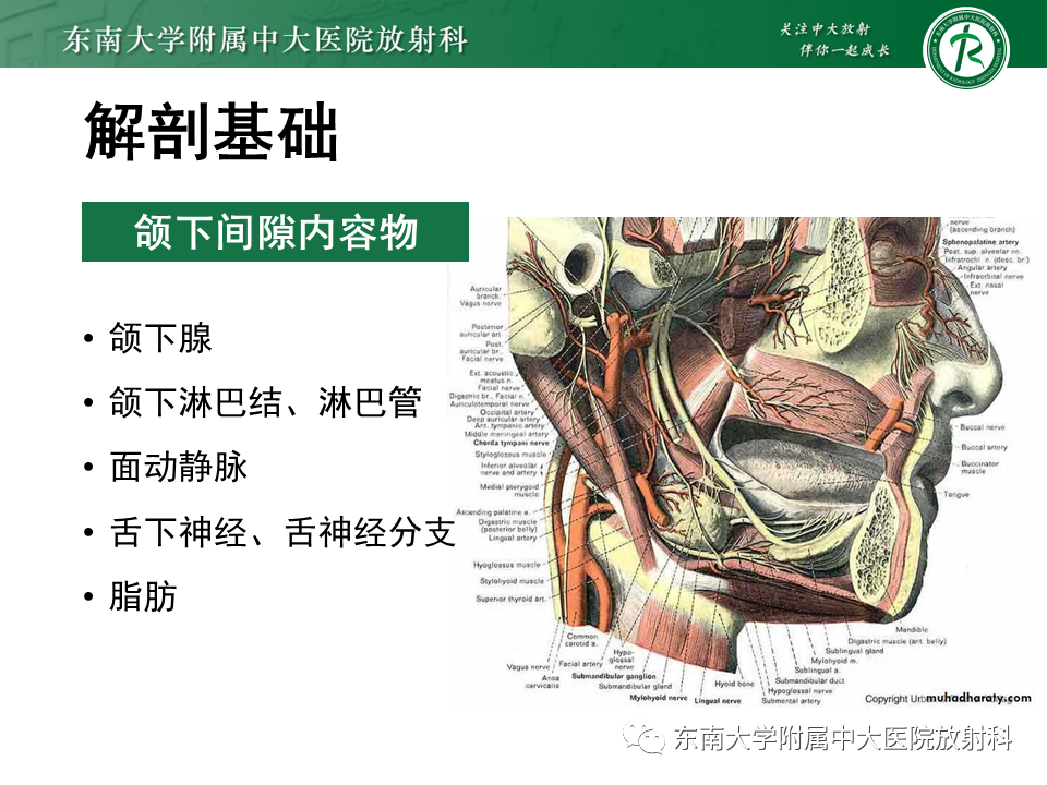影像PPT - 【PPT】颌下间隙病变影像诊断-26 影像PPT - 【PPT】颌下间隙病变影像诊断-26