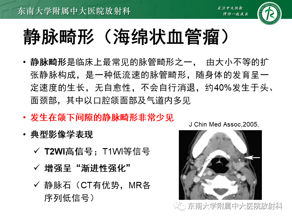 影像PPT - 【PPT】颌下间隙病变影像诊断-34 影像PPT - 【PPT】颌下间隙病变影像诊断-34