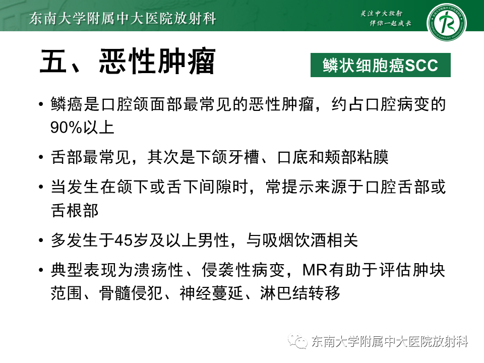 影像PPT - 【PPT】颌下间隙病变影像诊断-52 影像PPT - 【PPT】颌下间隙病变影像诊断-52