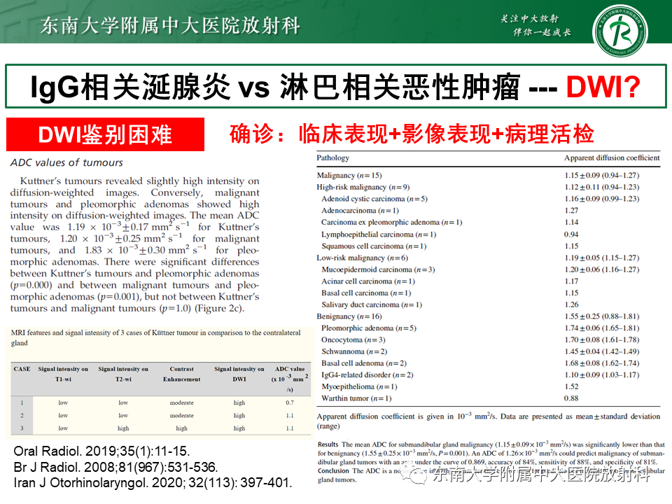 影像PPT - 【PPT】颌下间隙病变影像诊断-60 影像PPT - 【PPT】颌下间隙病变影像诊断-60
