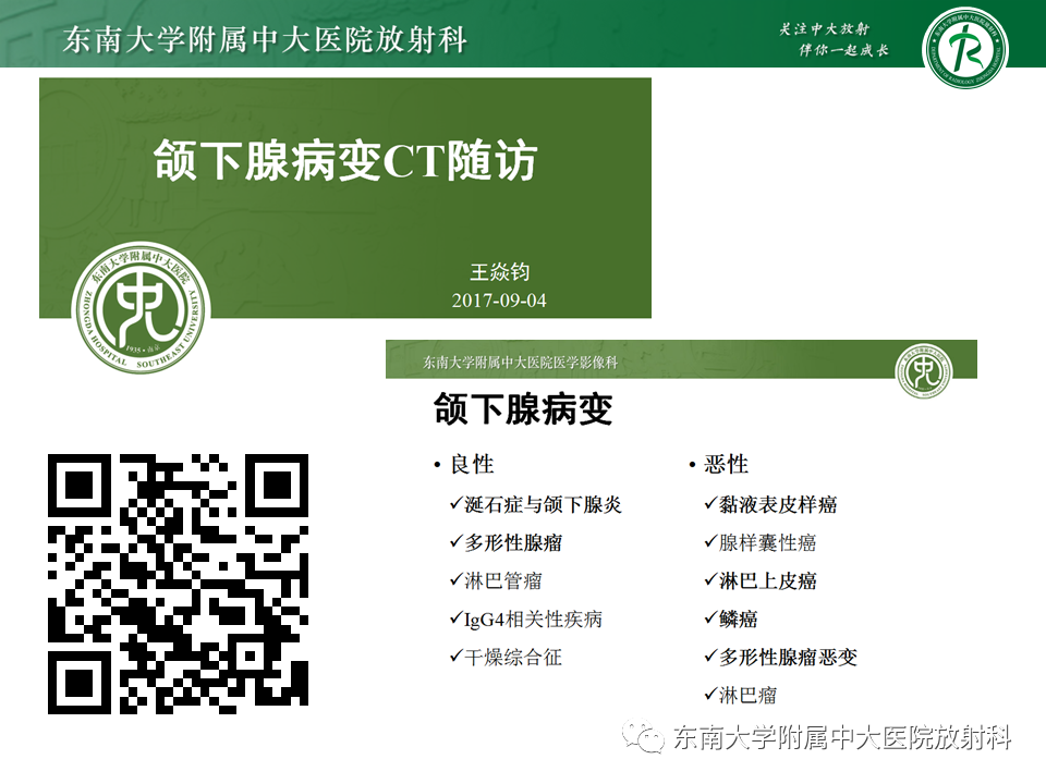 影像PPT - 【PPT】颌下间隙病变影像诊断-61 影像PPT - 【PPT】颌下间隙病变影像诊断-61