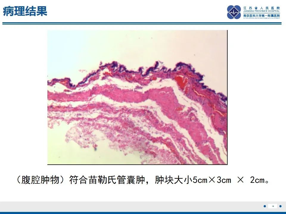 影像PPT - 【PPT】苗勒氏管囊肿-15