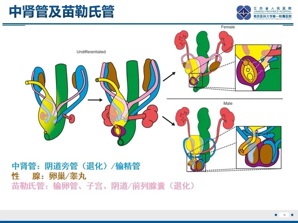 影像PPT - 【PPT】苗勒氏管囊肿-18