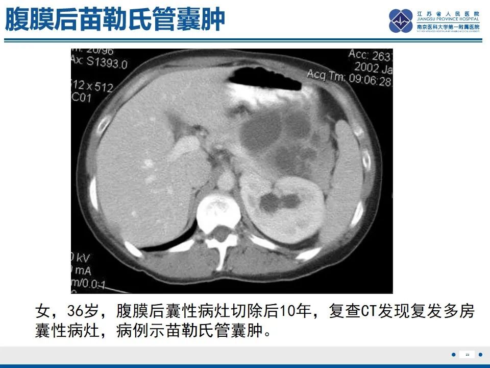 影像PPT - 【PPT】苗勒氏管囊肿-23