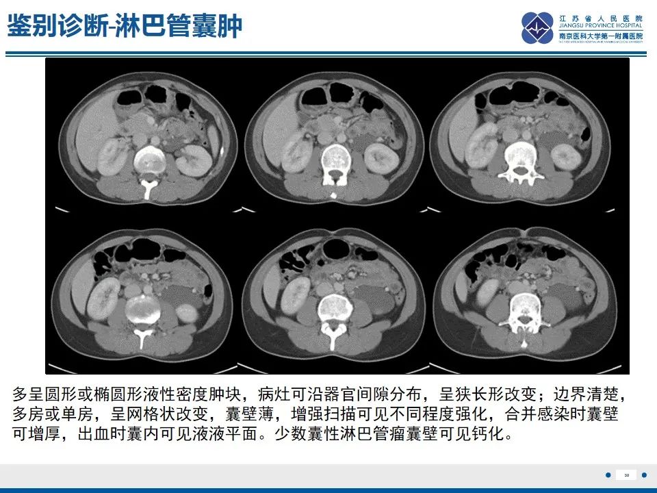 影像PPT - 【PPT】苗勒氏管囊肿-30