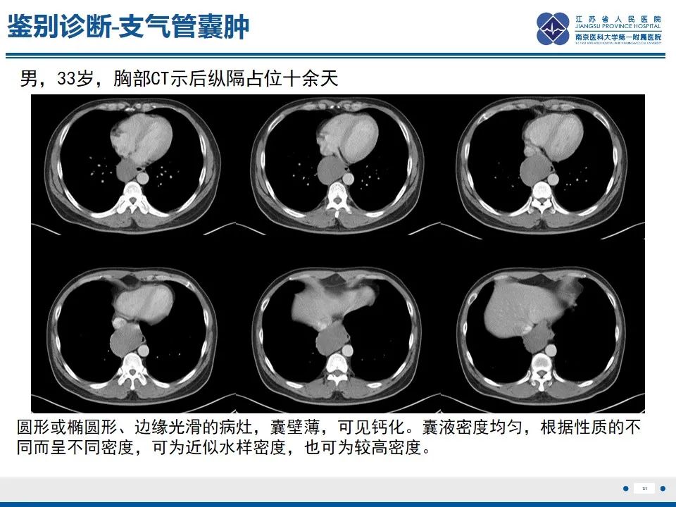 影像PPT - 【PPT】苗勒氏管囊肿-31