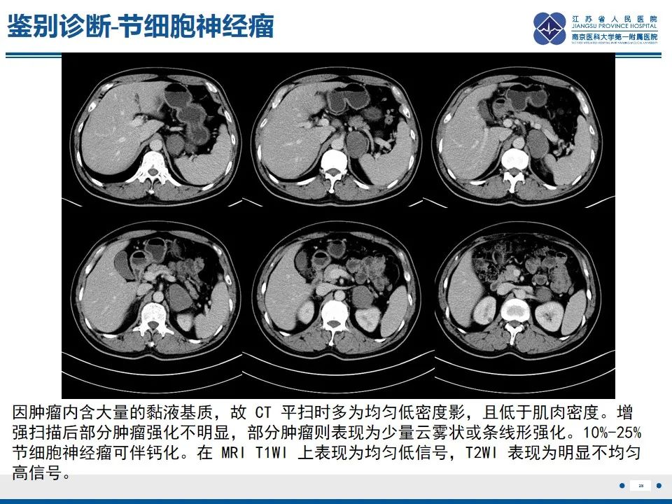 影像PPT - 【PPT】苗勒氏管囊肿-28