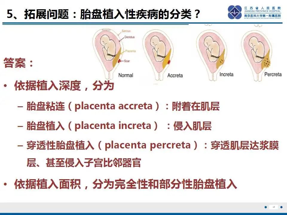影像PPT - 【PPT】胎盘植入性疾病-18