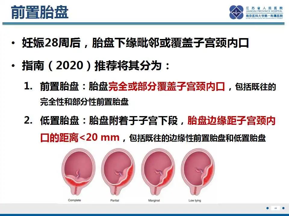 影像PPT - 【PPT】胎盘植入性疾病-21