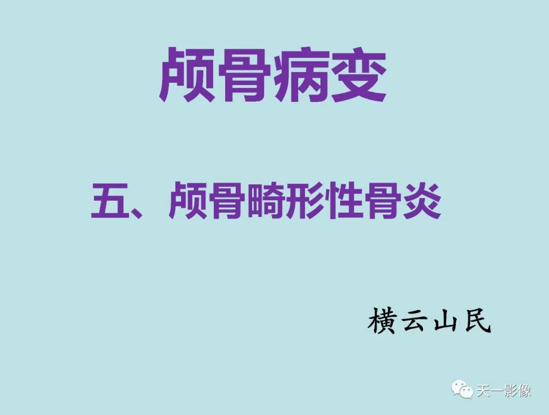 影像PPT - 【PPT】颅骨畸形性骨炎-1