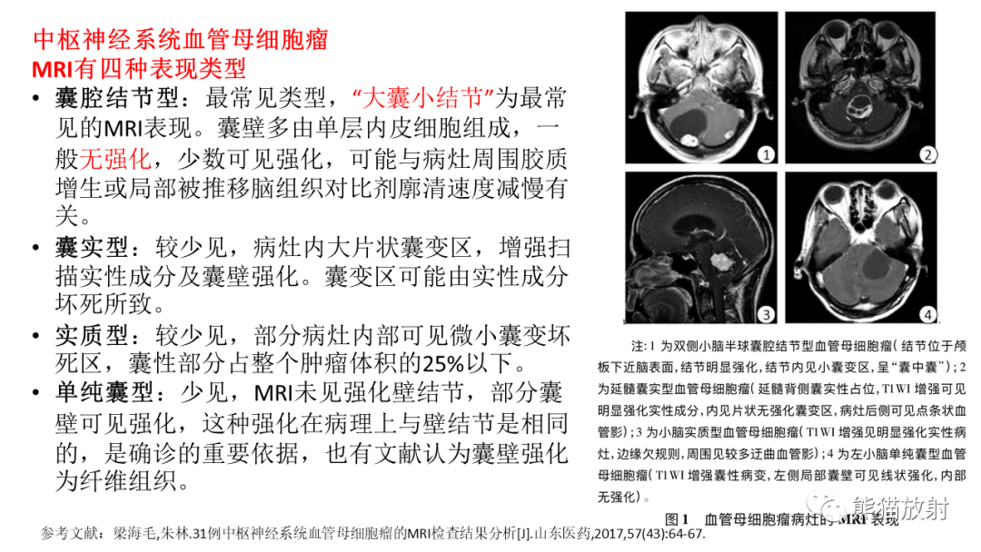 影像PPT - 【PPT】儿童后颅窝肿瘤—毛细胞型星形细胞瘤VS髓母细胞瘤-34